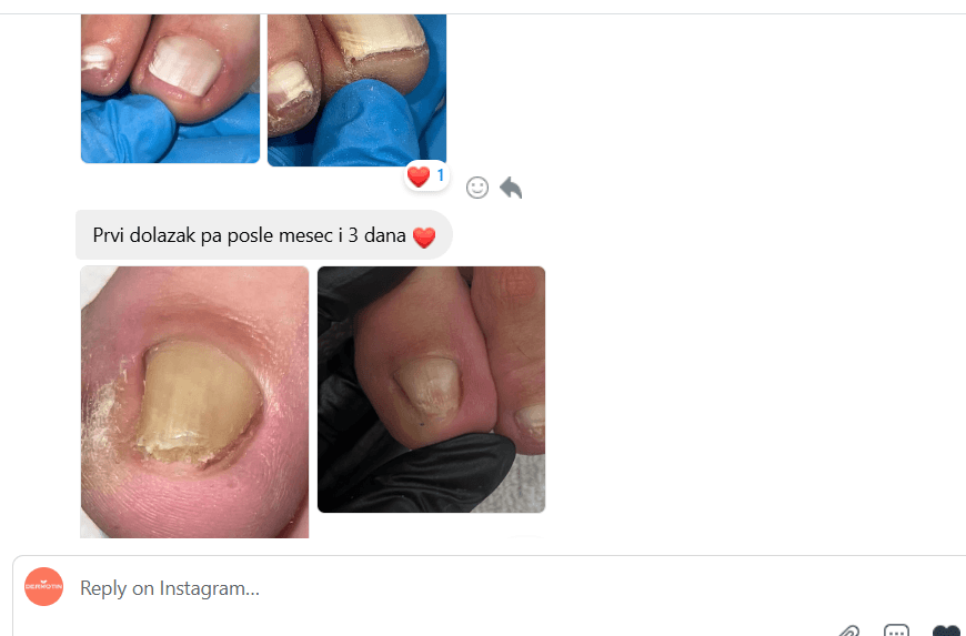 Komentar kupca