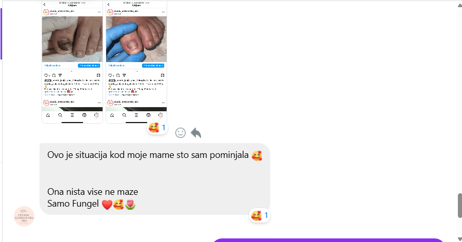 Komentar kupca