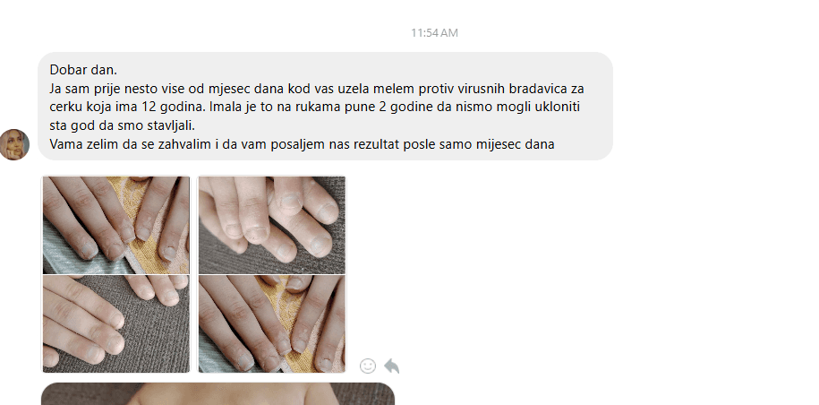 Komentar kupca